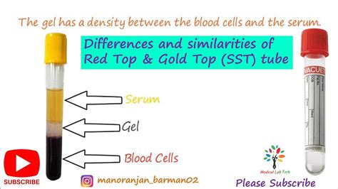 gold tubes for serum testing